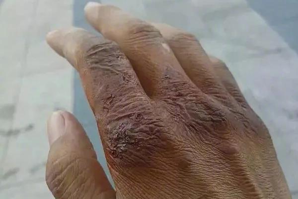 鬼谷八荒封灵阵的乌龟一碰就死怎么办